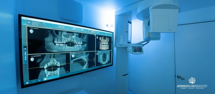 Slider image (8) Advanced Cabo Dentistry